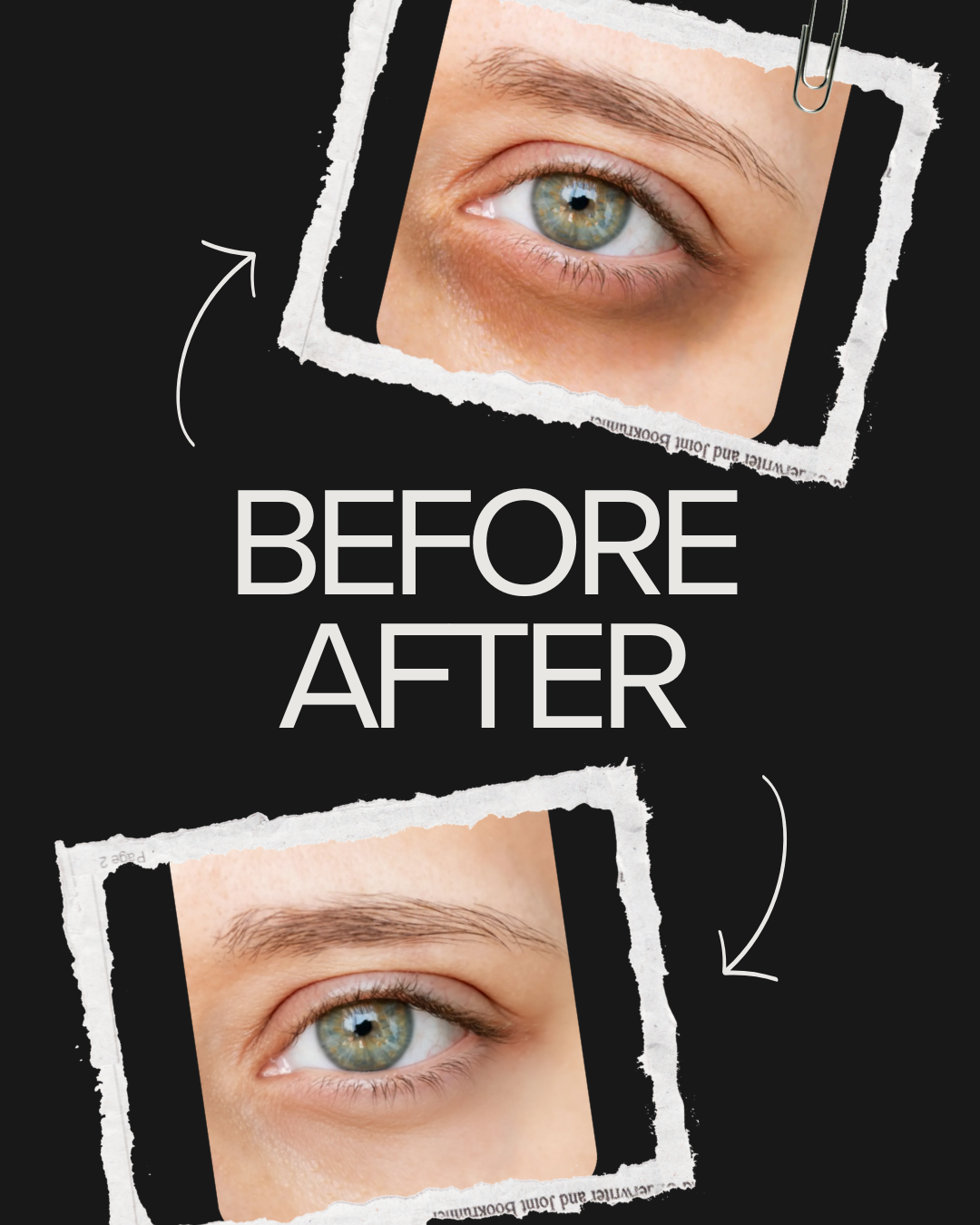 Avenelle Luxe Revitéa™ EMS Eye Massager – Red Light & Gentle Microcurrent Skincare Device