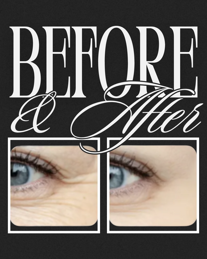 Avenelle Luxe Revitéa™ EMS Eye Massager – Red Light & Gentle Microcurrent Skincare Device