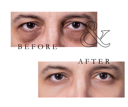 Avenelle Luxe Revitéa™ EMS Eye Massager – Red Light & Gentle Microcurrent Skincare Device